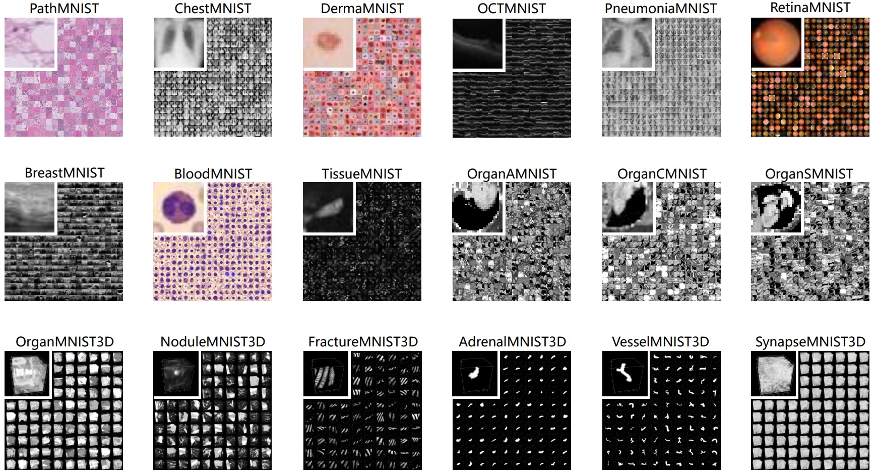 MedMNIST overview thumbnail from the dataset website