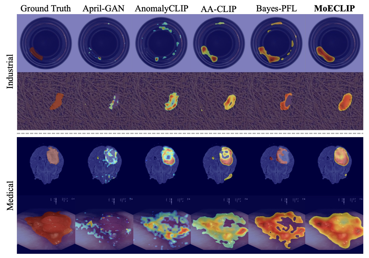 Qualitative anomaly-map comparison across industrial and medical examples, showing ground truth and localization outputs from prior methods and MoECLIP.